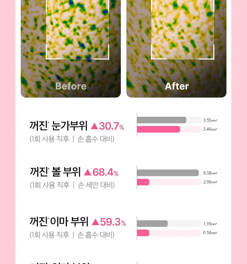 [3D진동클렌징/모공케어] 메디큐브 에이지알 부스터 진동 클렌저 헤드 (베이지/핑크) 상세페이지 57